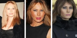 Photos : L'évolution physique de Melania Trump au fil du temps
