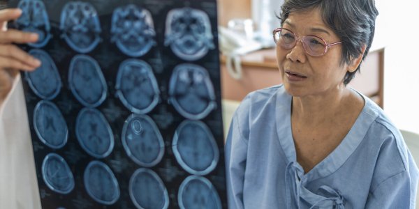 Deux nouveaux facteurs de risque d'Alzheimer viennent d'être confirmés