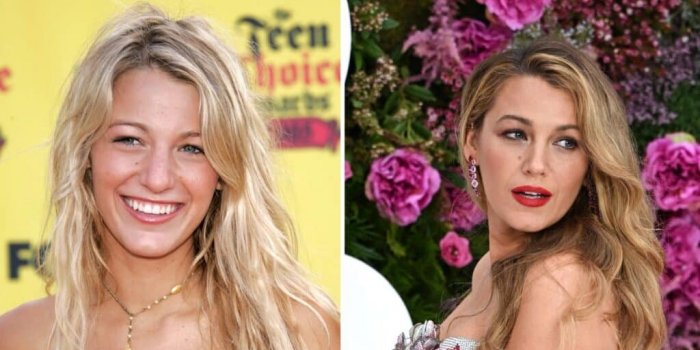 It Ends With Us (Jamais Plus) : Blake Lively se confie sur sa rhinoplastie, la "plus réussie d'Hollywood" selon les chirurgiens